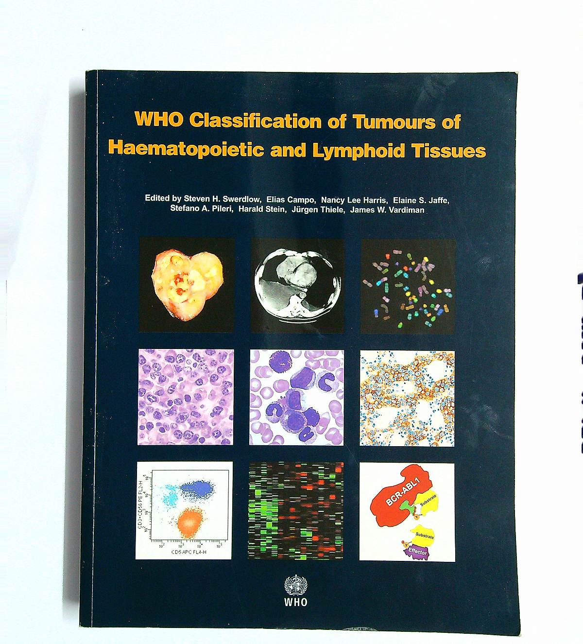 Who classification of tumours of haematopoietic and lymphoid tissues ...