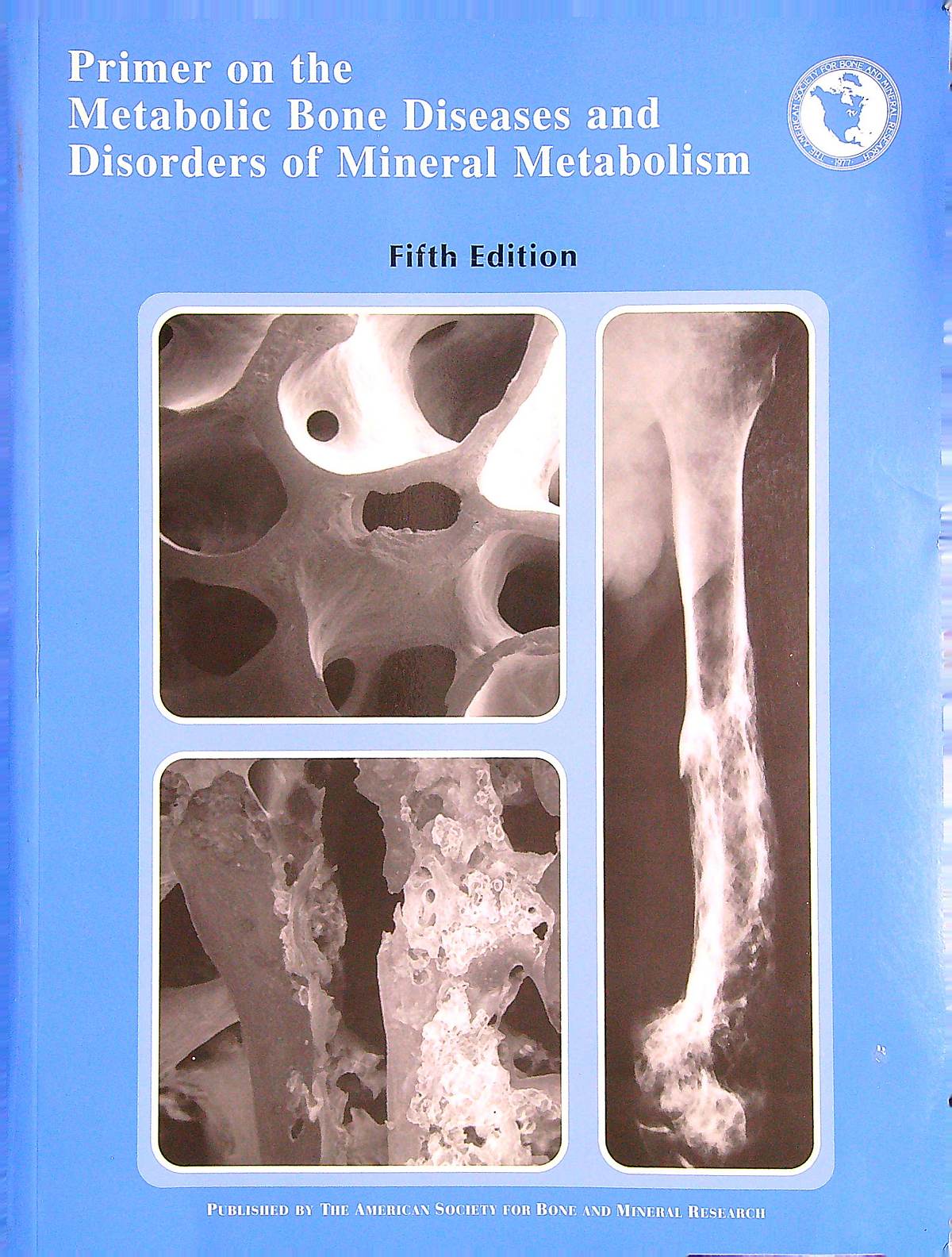 Primer on the metabolic bone diseases and disorders of mineral ...